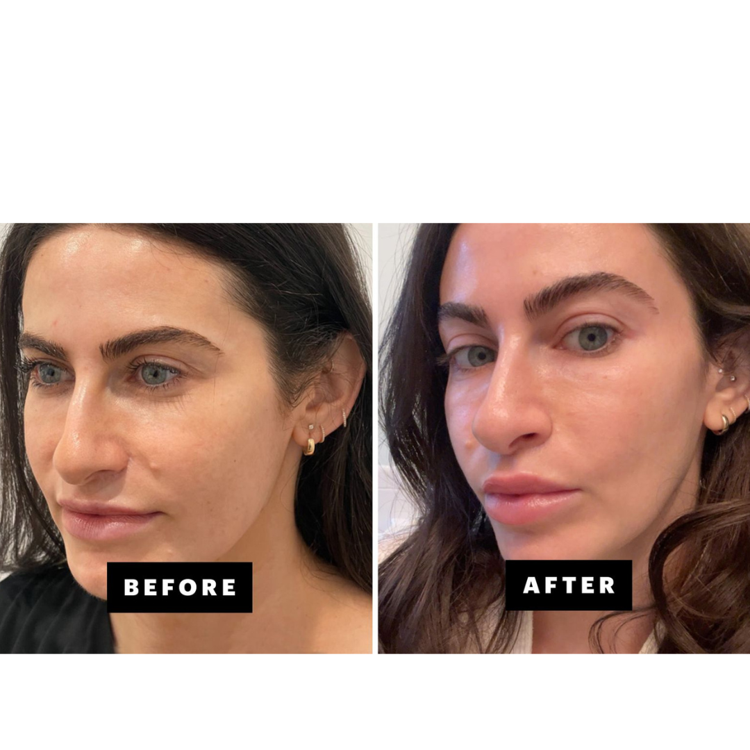 SAIQUE™ – Salmon DNA Collagen face Mask| Korean Hydration and Glow Overnight