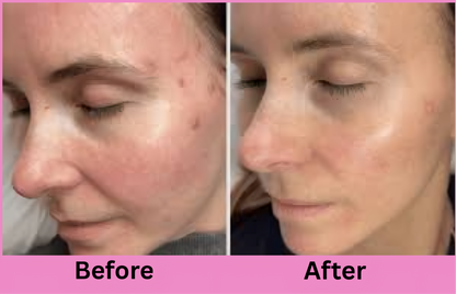 SAIQUE™ – Salmon DNA Collagen face Mask| Korean Hydration and Glow Overnight